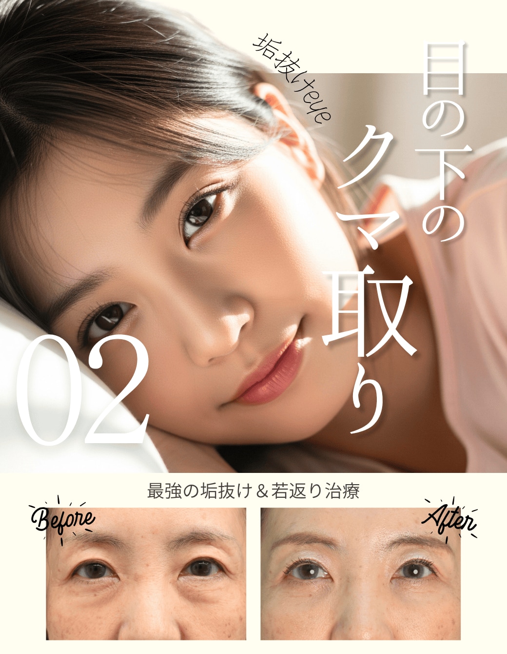 【隠せないクマ】男女問わず人気のクマ取りで究極の若返り！